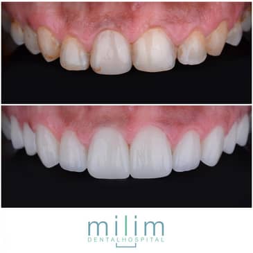 Slider image (5) Milim Dental